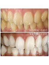 ホワイトニングルーム 川崎店(WhiteningRoom)/ホワイトニング/川崎