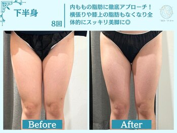 フローフシ∞/【痩身】下半身・お尻の脂肪撃退