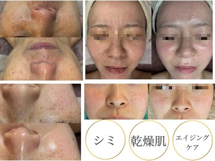 ココリールの写真