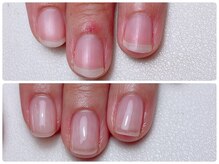 寺子屋ビューティーズ(寺子屋Beauty's)/自爪育成で爪を綺麗に