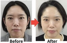 ブプラ 相模大野店(BUPURA)