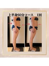 レアーレグロウ(Reale Glow)/Before→After