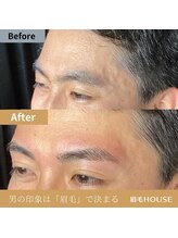 ハウス 新宿店(HOUSE)/お客様の施術例(新宿/代々木)