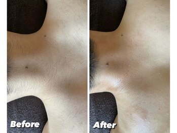 ダウニー(Downy)/20代/男性/プログラマー