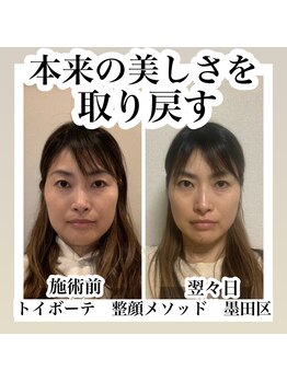 トイボーテ(toi beaute)/人生を変えるエステ！！