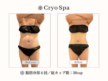 クリオスパ せんげん台駅前店(Cryo Spa)