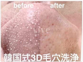 ヴィーヴ 京橋(vive)/【韓国式3D毛穴洗浄】