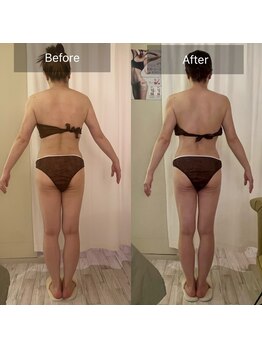 エメ(Aimer)/【40代結果☆両太ももで-10cm】