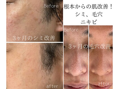 カラン(CALIN)の写真