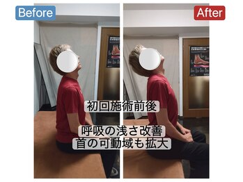 アンティオール 札幌店/40代男性　自律神経の乱れ