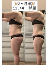 ユノン(yunon)/ビフォーアフター