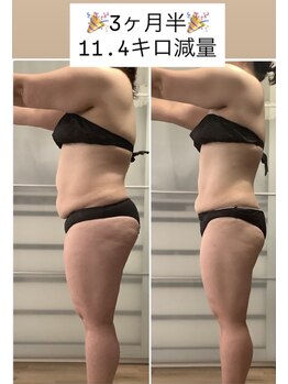 ユノン(yunon)/ビフォーアフター