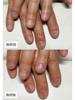 パラスパガーデン センダイ アングゥ(para spa GARDEN sendai ungu)/◇甘皮すっきりネイルケア