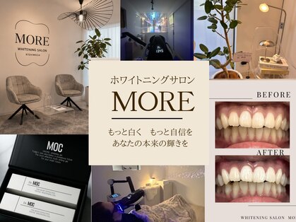 《医療提携×結果重視》ホワイトニングサロンMORE【岸和田/和泉】の写真