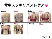 エステティック レイビス 秋田店(RAYVIS)/背中スッキリバストケア！