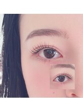 レスカ(Lesca)/パリジェンラッシュリフト