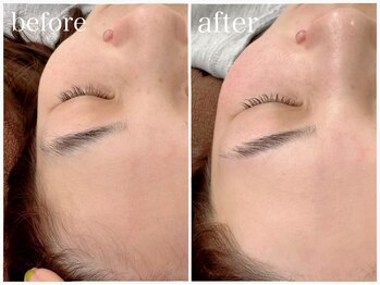 ソアラ(soara)/フェイシャルワックス脱毛+美眉