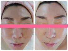 アズ(AZU)/50代女性before after