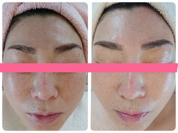 アズ(AZU)/50代女性before after