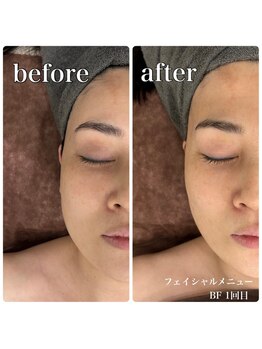 サロンドルクリア(Salon de LUCULIA)/エステ ＃スッキリ小顔コース