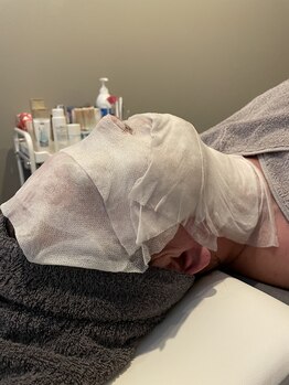 カシェットベルメイユ 名古屋久屋大通(Cachette Vermeil)/カーボキシー活性/くすみ.毛穴に