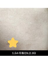 レイ(R.E.I)/【脱毛アフター】お腹