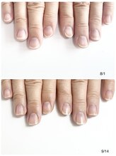 ルクレール カシェット(Le clair cachette)/美爪育成3ヶ月コース