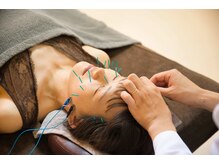 サロン ベラータ(Bellata)の雰囲気（当院では痛みや負担が少ない施術を心がけております。）