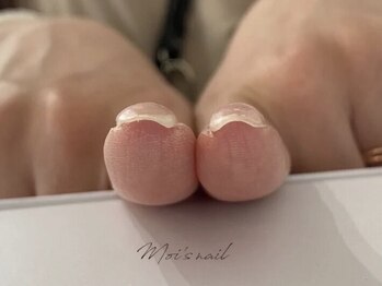 モワズネイル(moi's nail AS ONE IS)の写真/《小倉駅徒歩3分》爪の状態を見極め丁寧にご提案◎理想の爪を目指す！
巻き爪ケアができるサロン☆