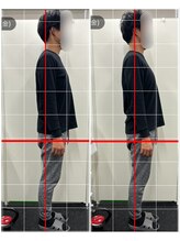 フィットリカバリー(FITリカバリー)/姿勢の変化　施術前後