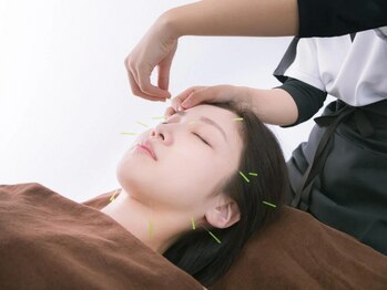 セレナ整骨院　池袋院の写真/お顔のむくみを解消し、理想の美小顔に！リフトアップにも◎日々の疲れからくる肩こり・腰痛改善は鍼灸で！