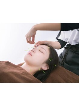 鍼灸施術を受けたい