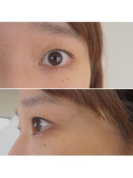 スーコ アイビューティー(suco)/