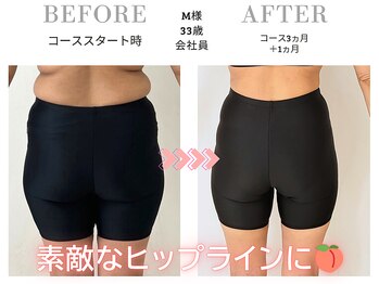 スリービーダイエット 町田店/ヒップアップの成果