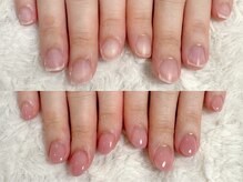 グラシナ なんば店/深爪/自爪育成/フィルイン