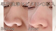 アイビ(愛美)