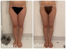 美人バスト 渋谷店/【痩身・ダイエット】 渋谷/脚☆