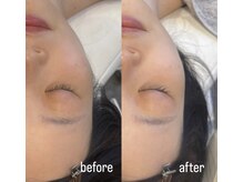 ペネロピ(Penelope)/ララピール