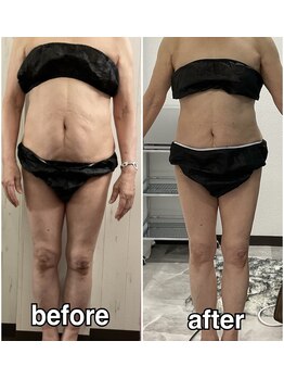 輝 らいと/ビフォーアフター(正面)