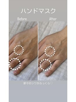 シーオングル(Siii ongle)/フットをしながらハンドマスク
