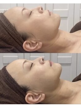 ルルアス(LuLu AS)/透明感アップ