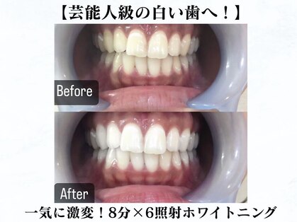ラブホワイトニング 新宿店(LOVEホワイトニング)の写真