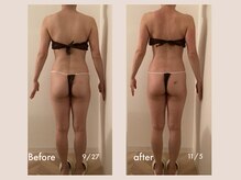 レモン(Lemon)/ビフォーアフター