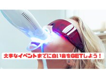 シュシュ(ChouChou)