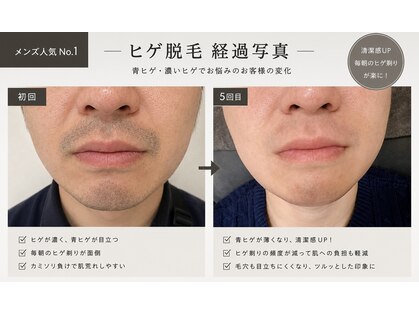 サロンノア(salon NOA)の写真