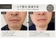 サロンノア(salon NOA)の写真