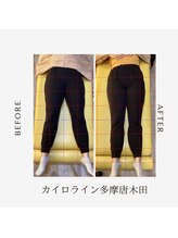 多摩 唐木田整体室/産後骨盤のビフォーアフター