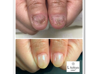 エル トウキョウ キャンディ(L tokyo CANDY)の写真