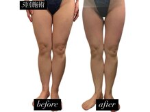 痩身革命 大宮店/ダイエットリンパマッサージ
