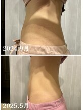 スペラ(Spera) 腸